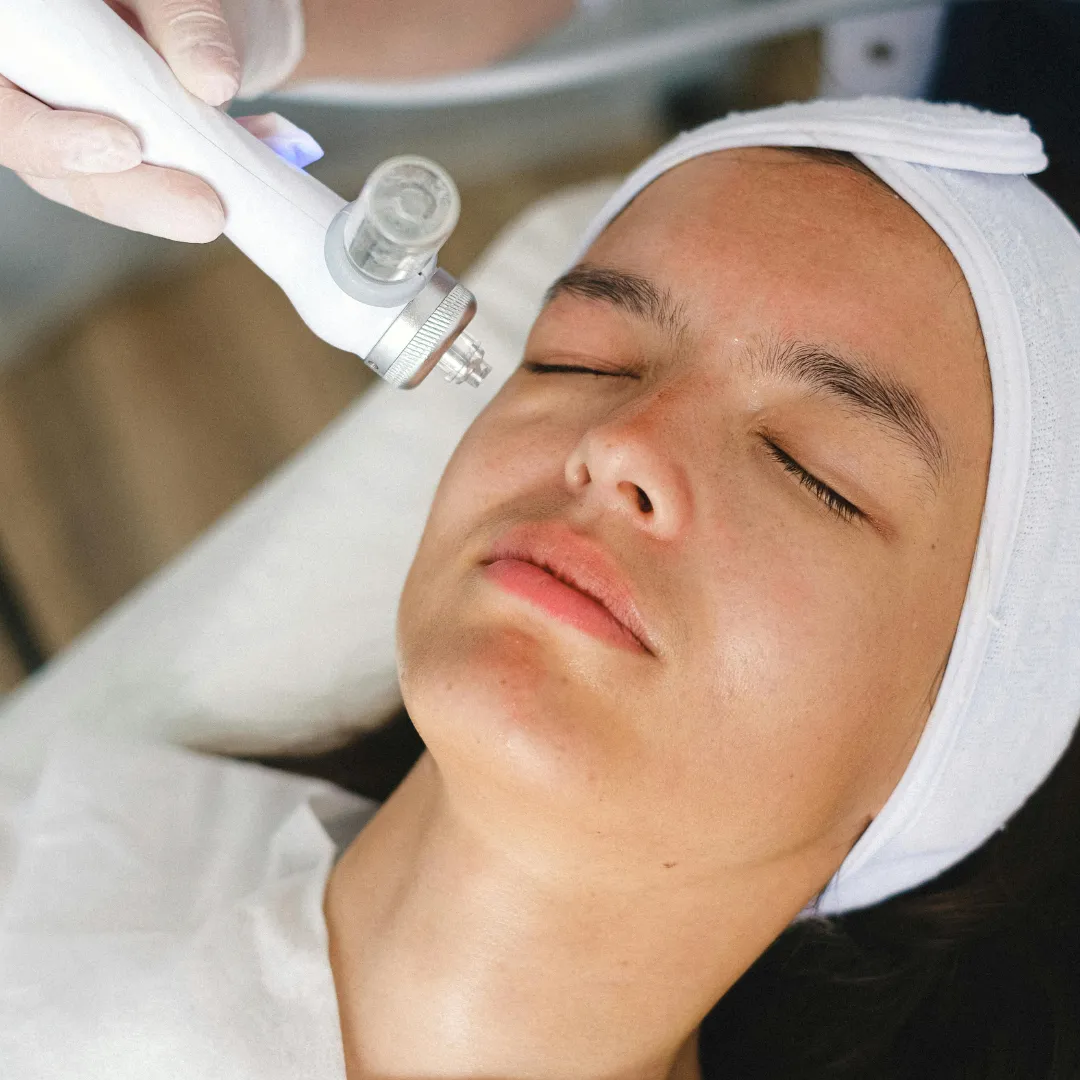 Advanced Laser Acne Therapy