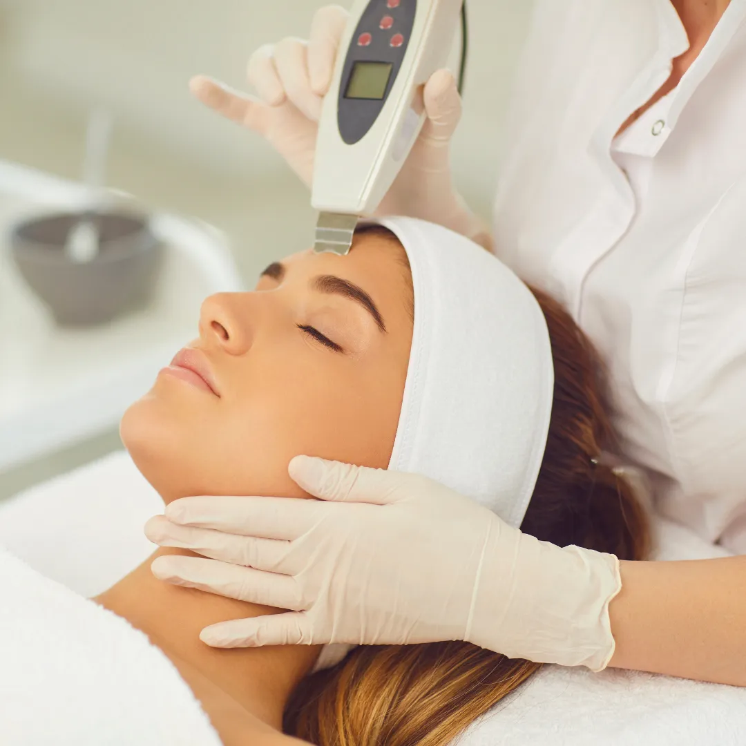 Chemical Peel Acne Scars Coimbatore