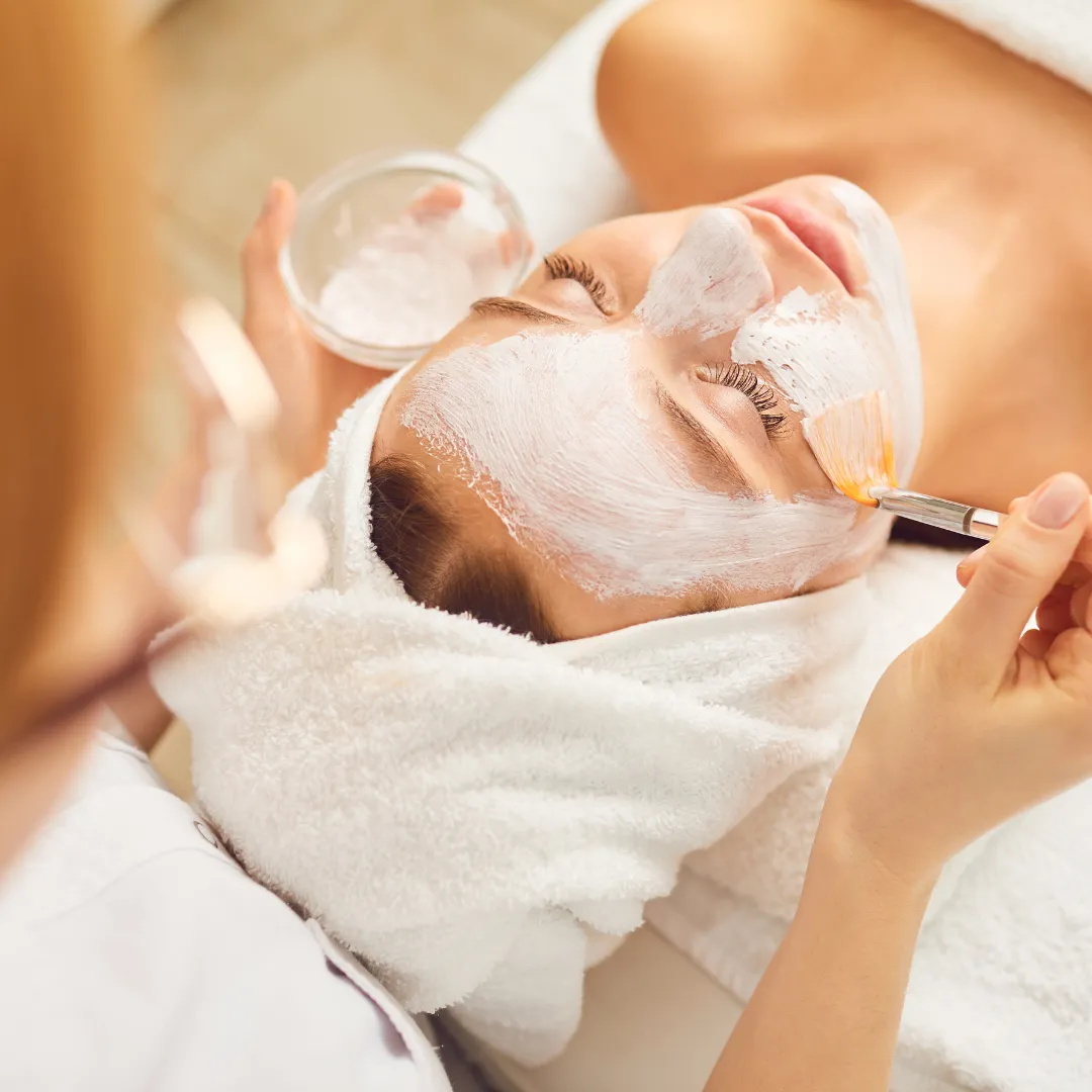 Chemical Peel for Acne Scars
