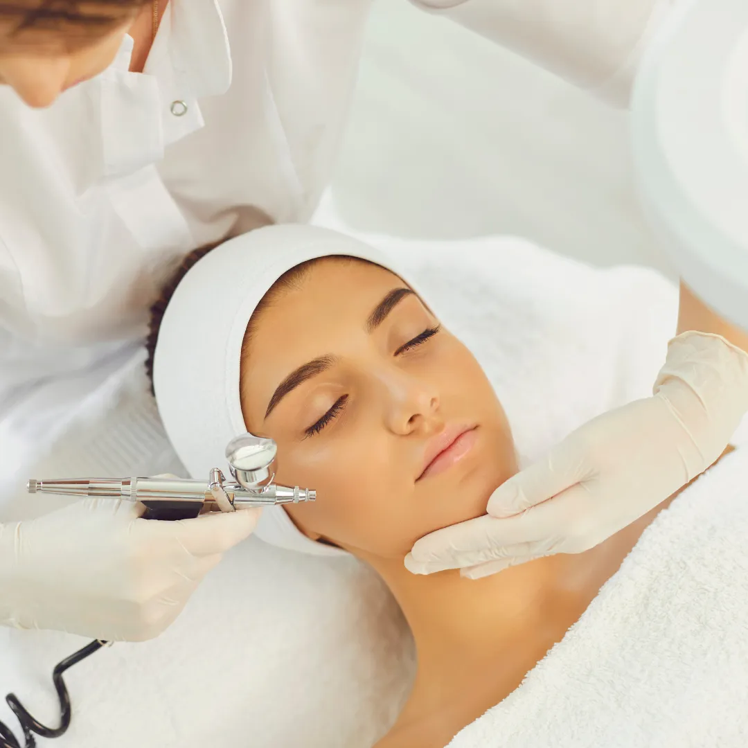 Chemical Peel for Pigmentation