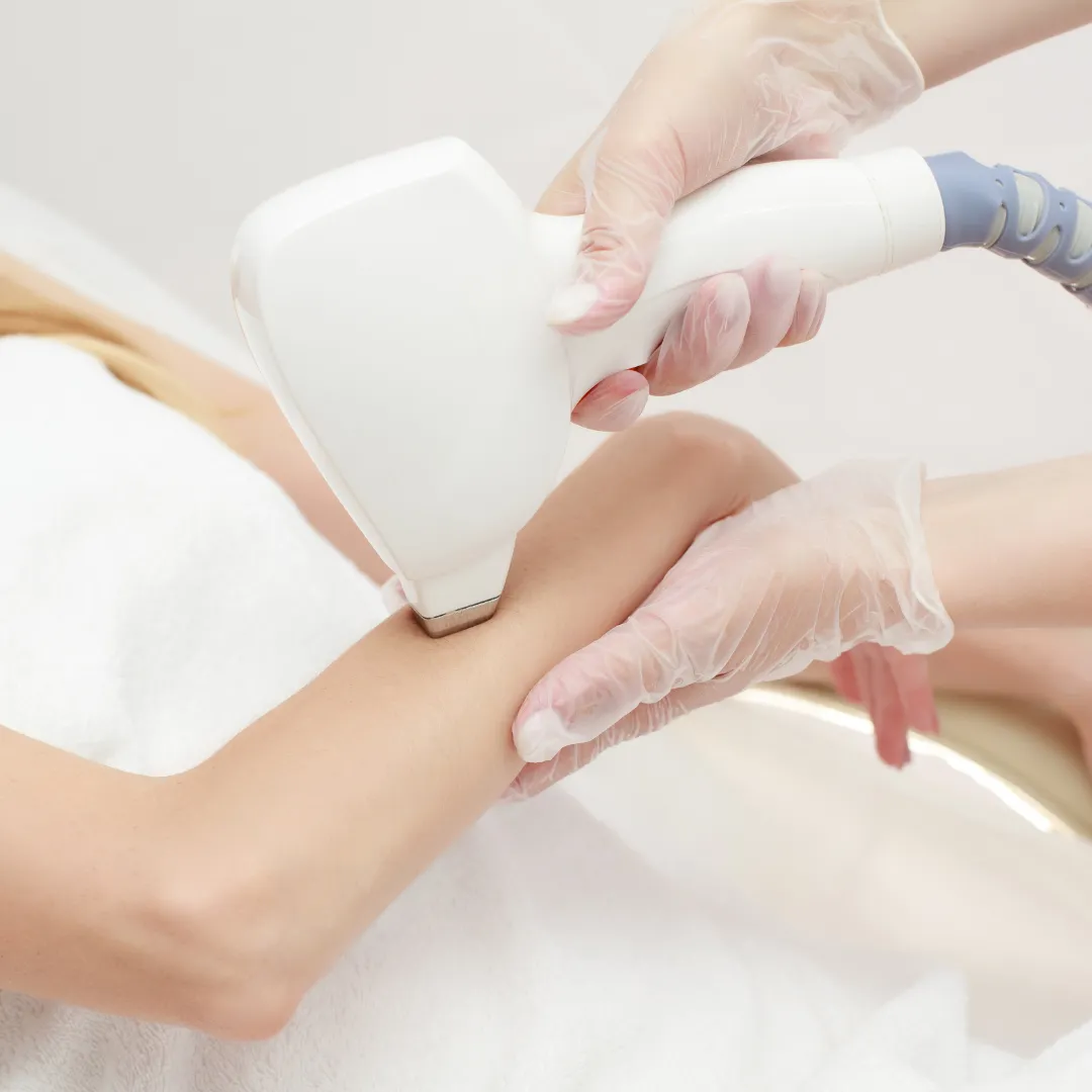 Full Body Laser Hair Removal