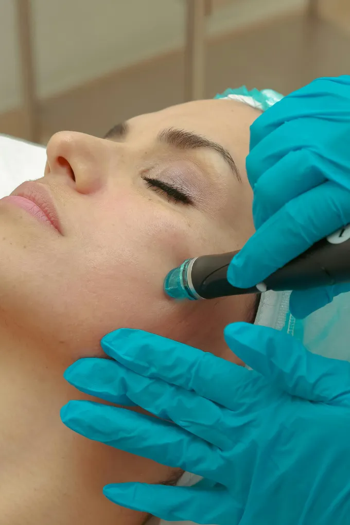 Hydra facial Treatment