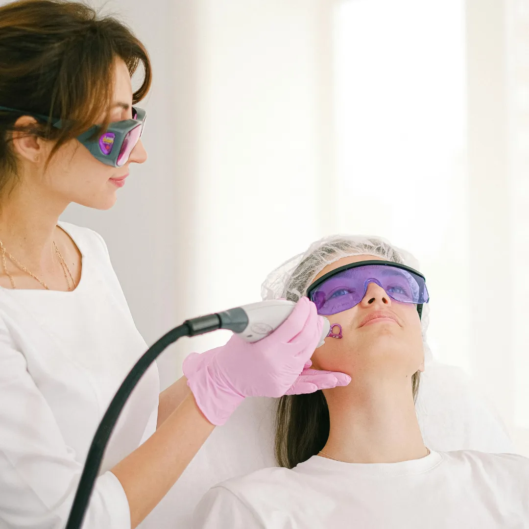 Laser Acne Scar Removal Coimbatore