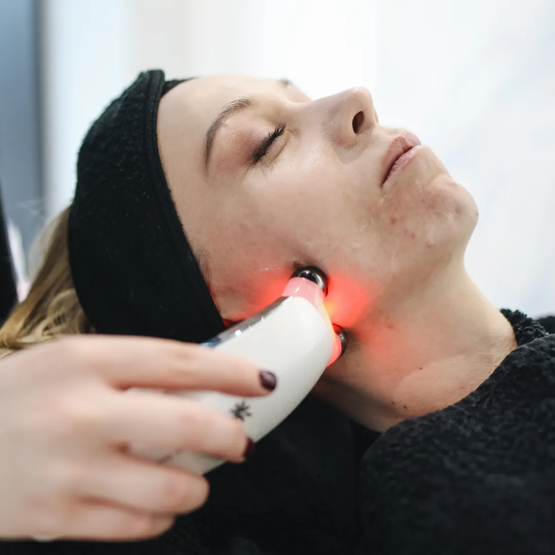 Laser Facial Treatment