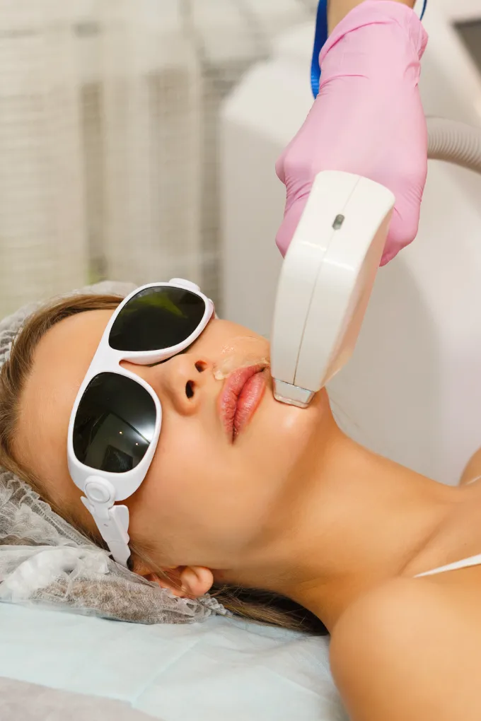 Laser Hair Removal in Coimbatore