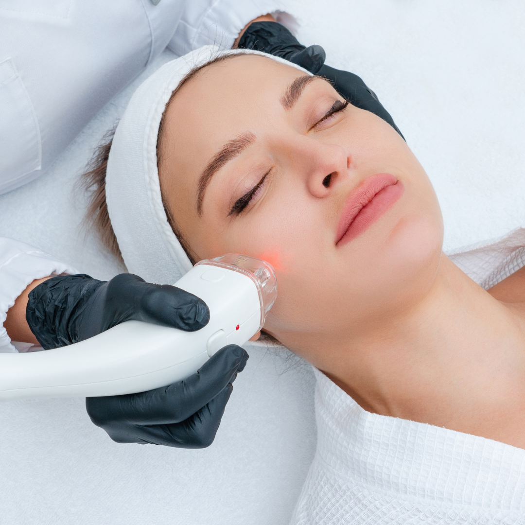 Laser Skin Whitening Treatment