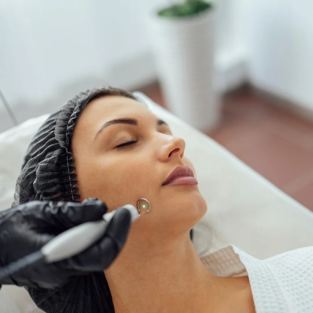 Laser Treatment