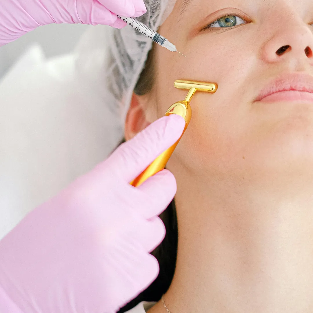 Microneedling Treatment for Acne Scars