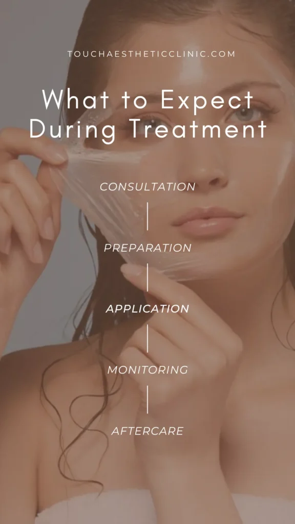 Chemical Peel - Expect During Treatment