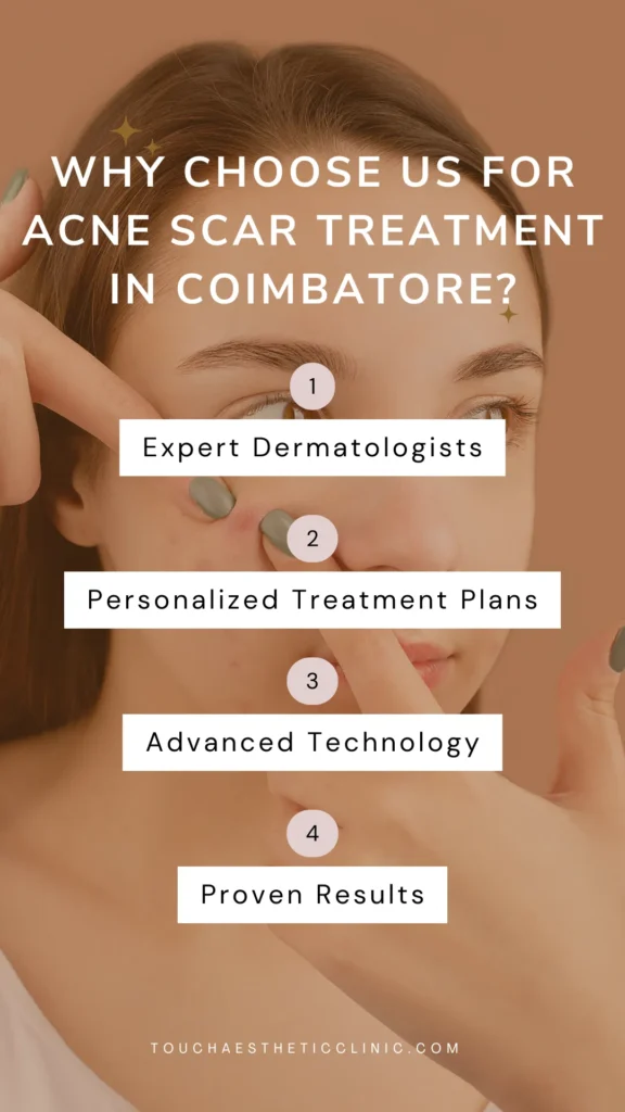Why Choose Us for Acne Scar Treatment in Coimbatore