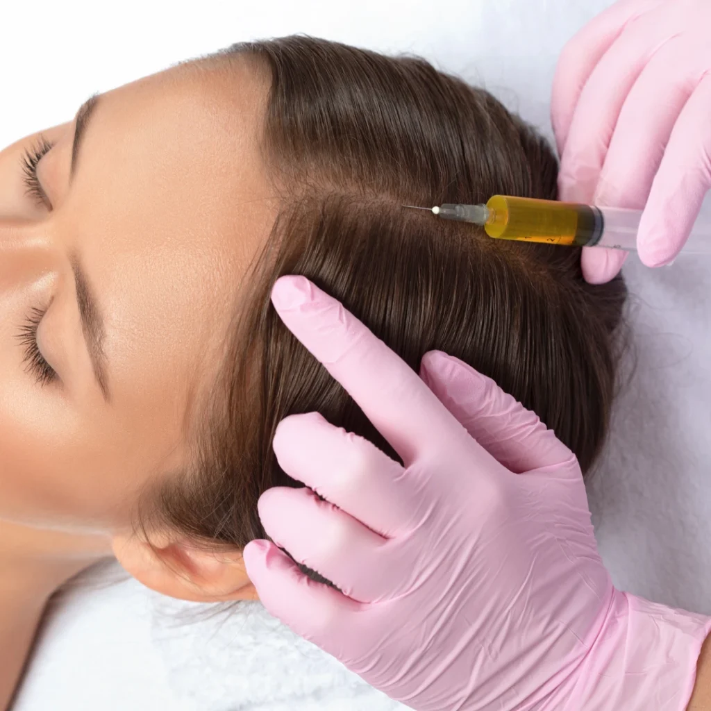 Best PRP Hair Treatment in Coimbatore 2