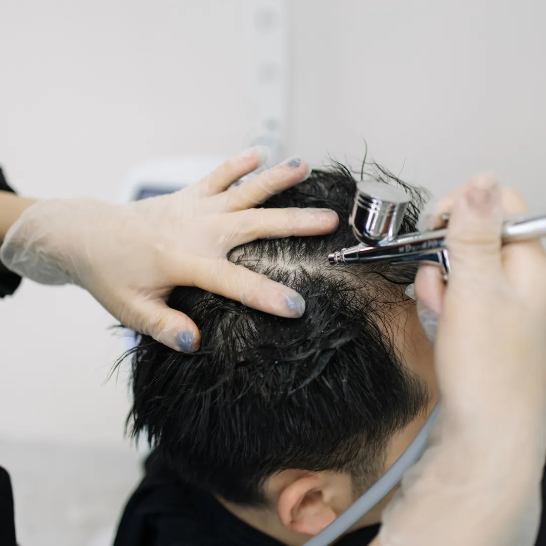 Dry Scalp Treatment