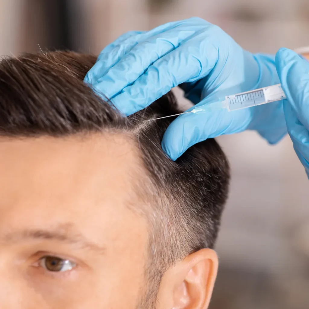 Hair loss treatment