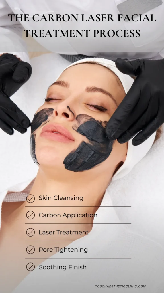 The Carbon Laser Facial Treatment Process