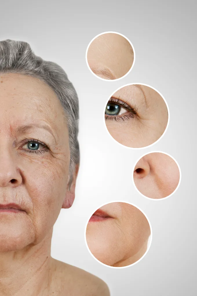 Old Age Skin Problems Treatment