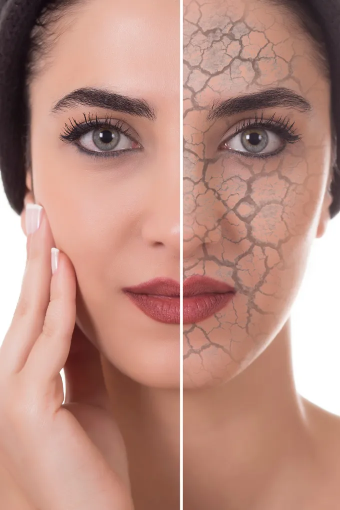 Dry Skin Treatment in Coimbatore