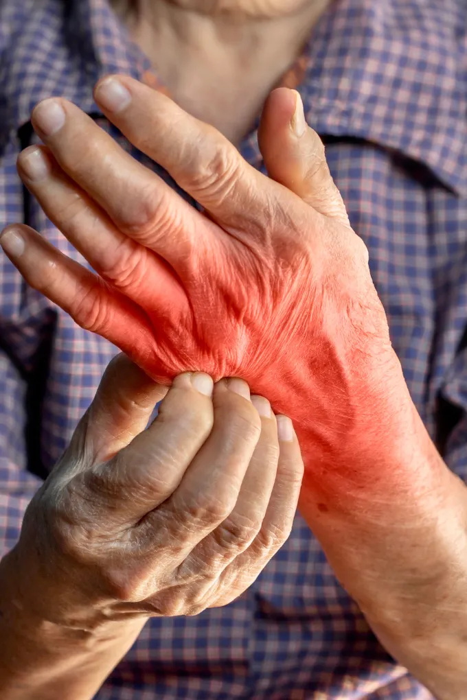 Fungal Infections Treatments in Coimbatore