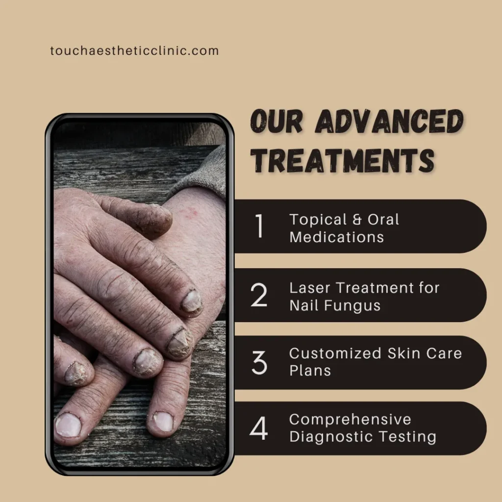 Advanced Treatments