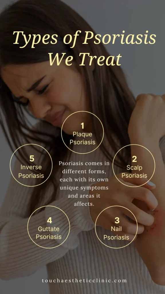 Types of Psoriasis We Treat
