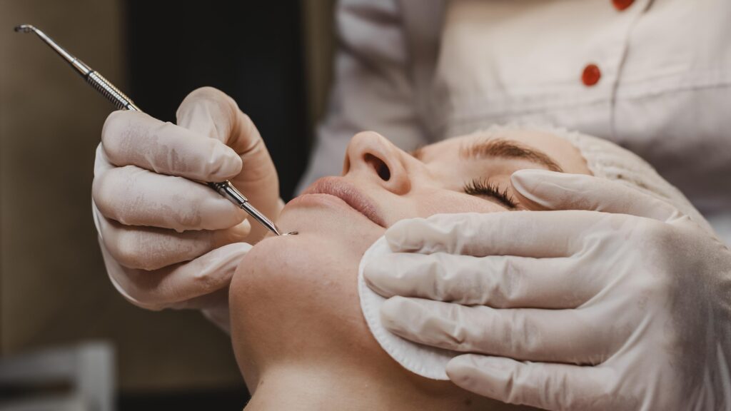 pimple treatment