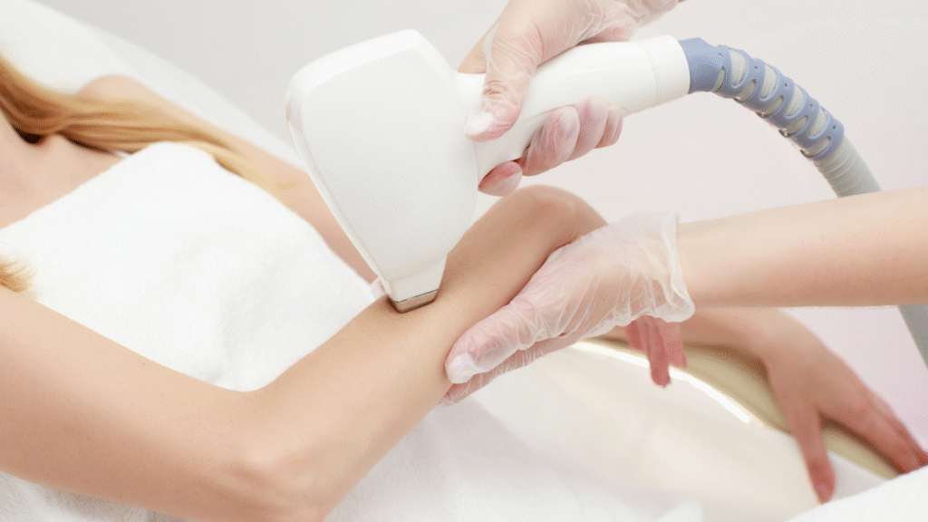 laser hair removal treatment