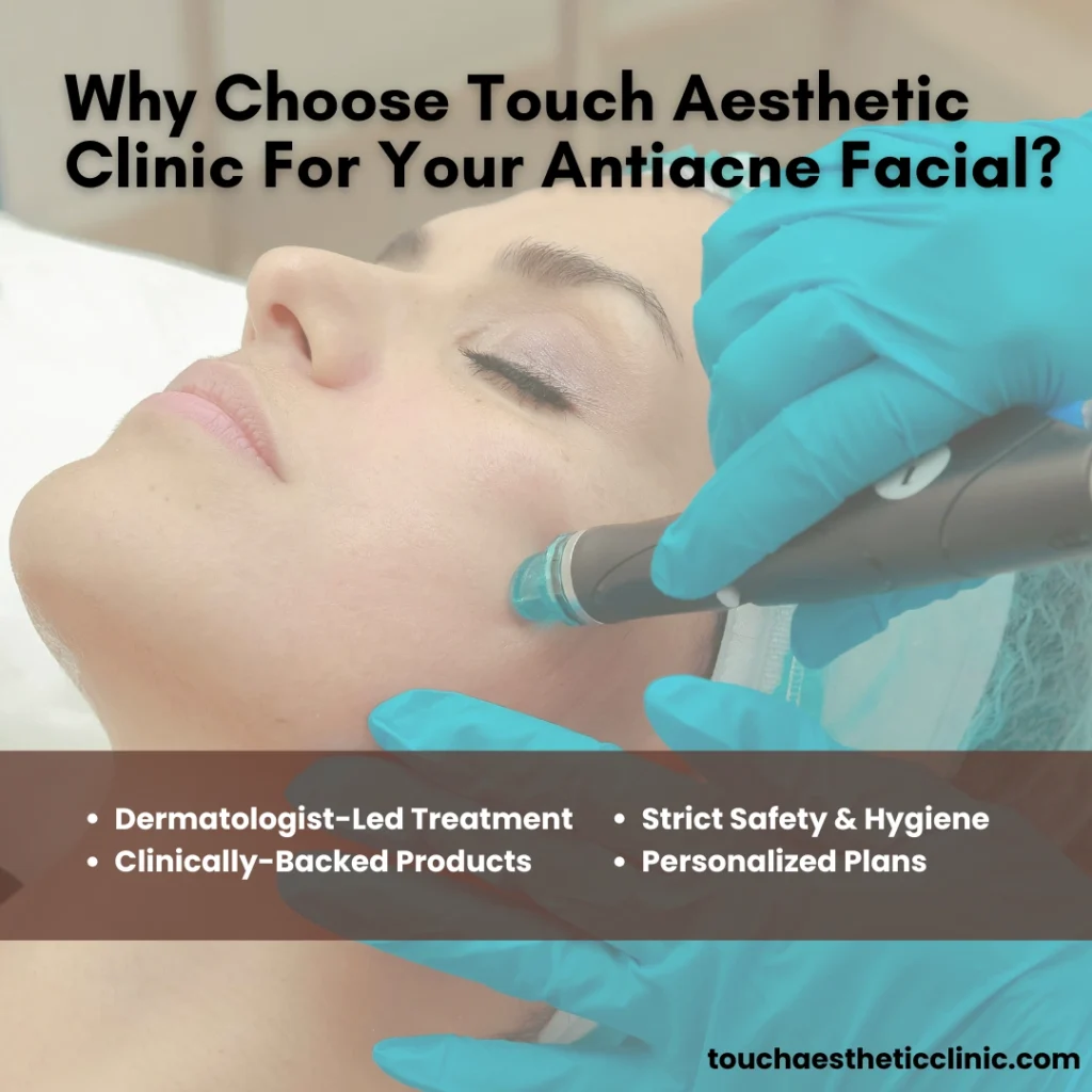 Antiacne Facial Treatment
