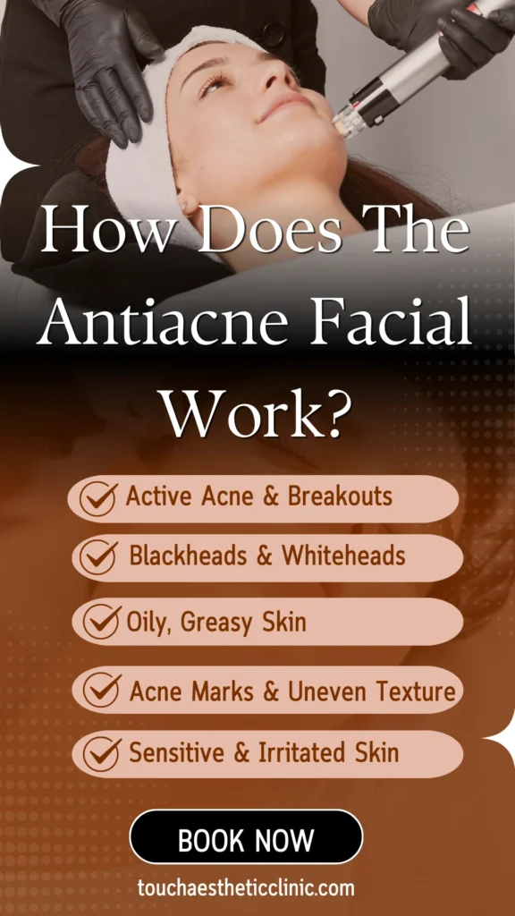 Antiacne Facial Treatment