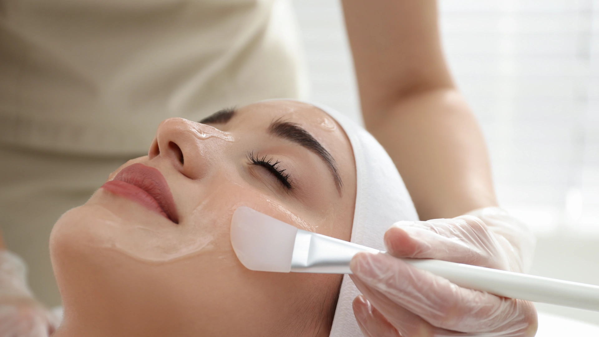 Chemical Peel treatment