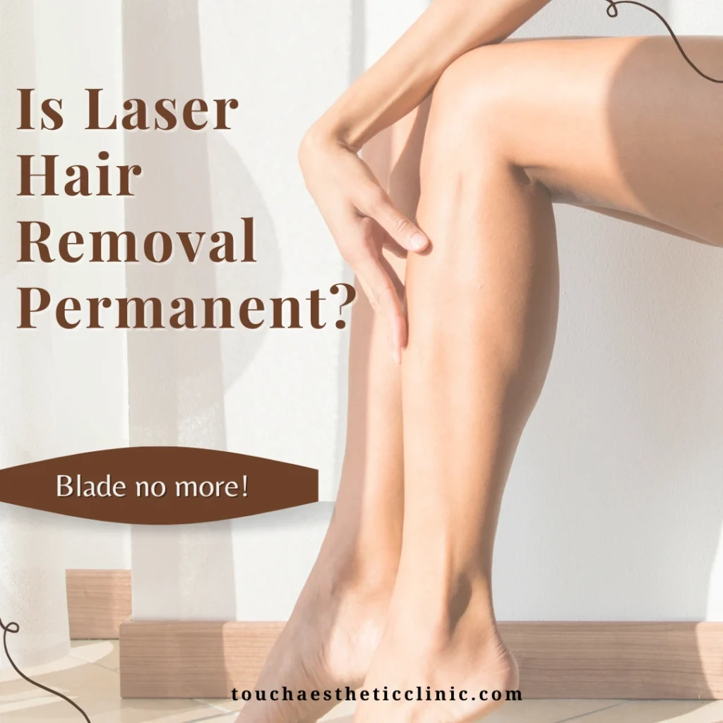 Is Laser Hair Removal Permanent?