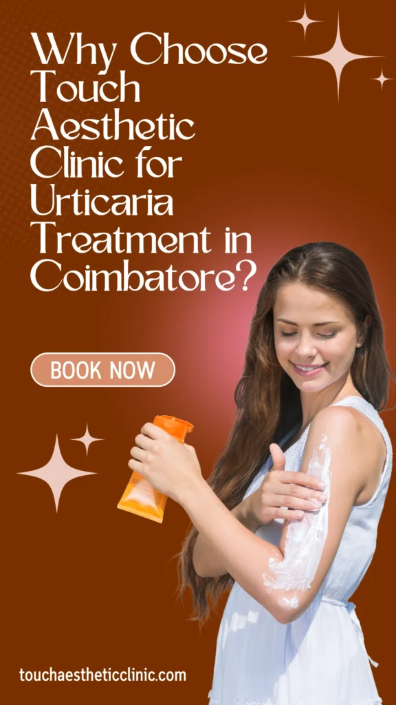 best urticaria skin treatment