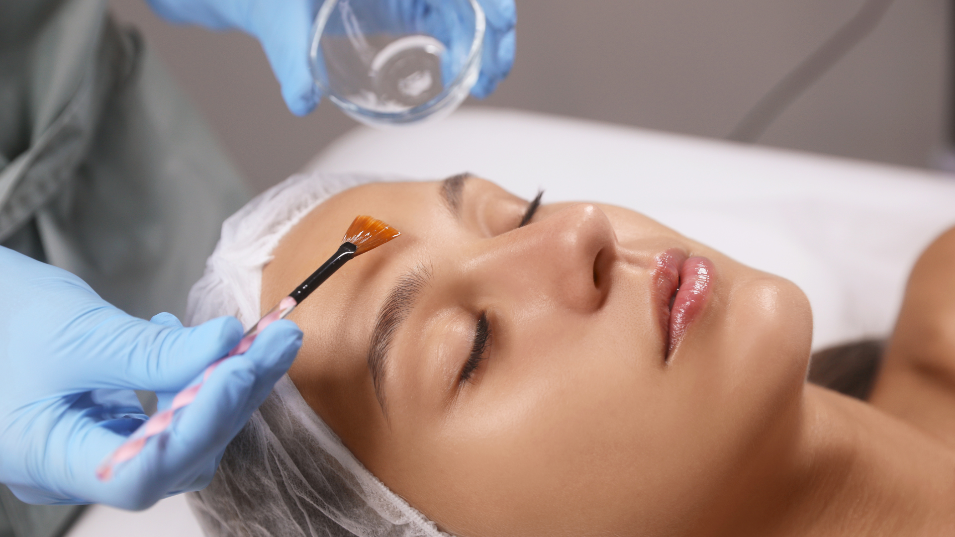 Chemical Peel Treatment Coimbatore