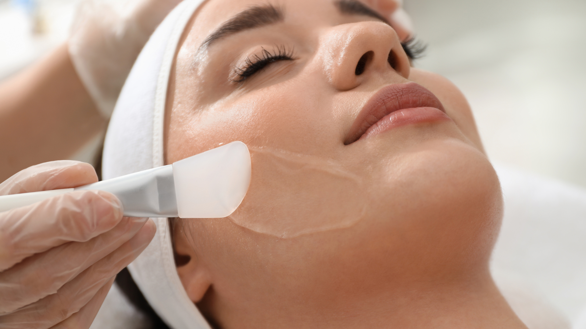 Best Chemical Peel Treatment