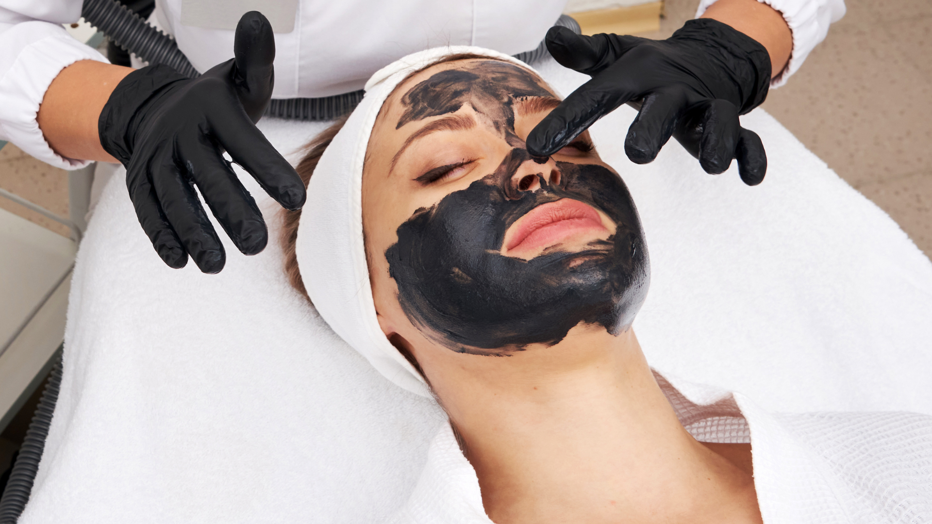 Chemical Peel Treatment in Coimbatore