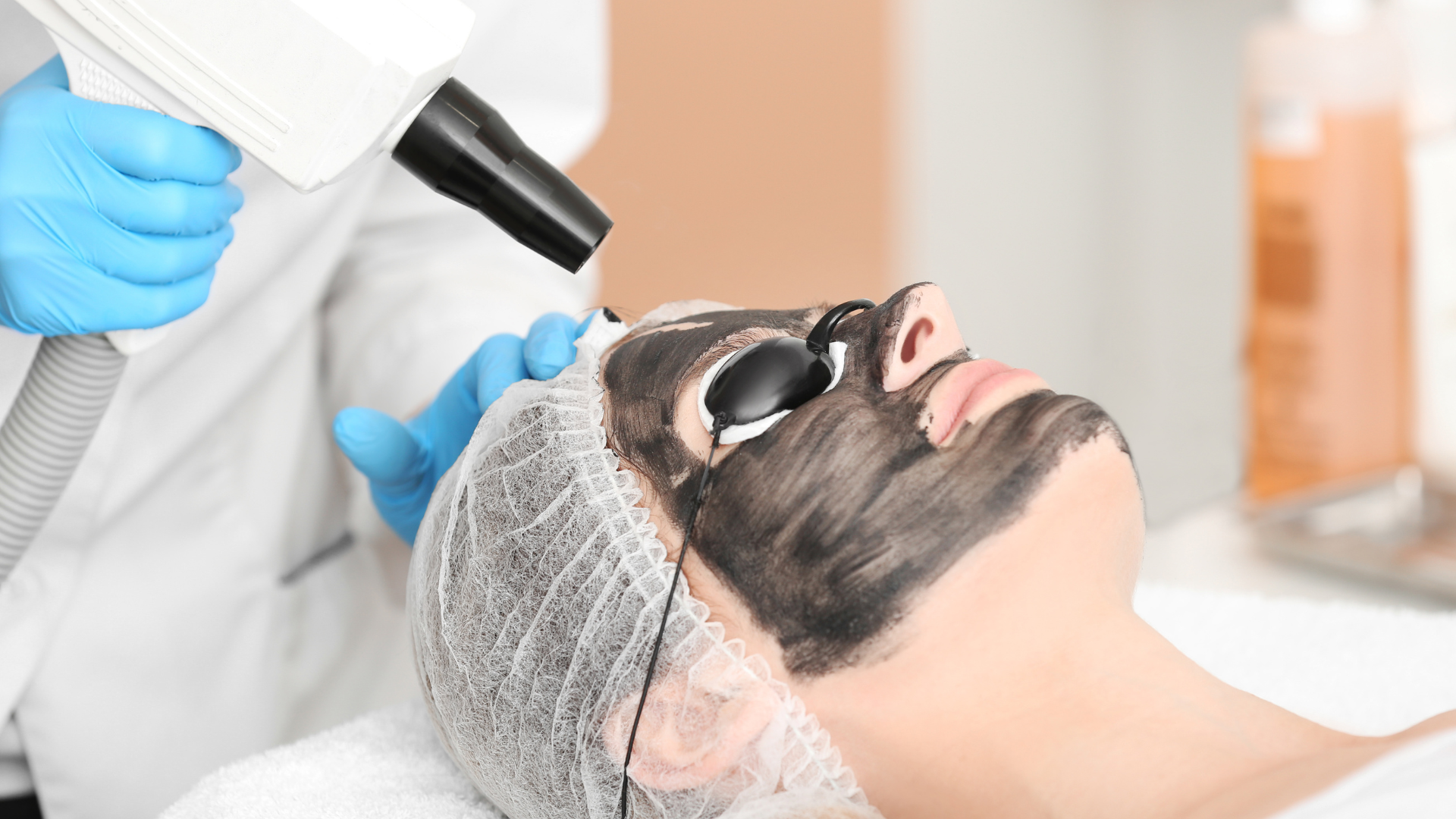 best chemical Peel treatment in coimbatore