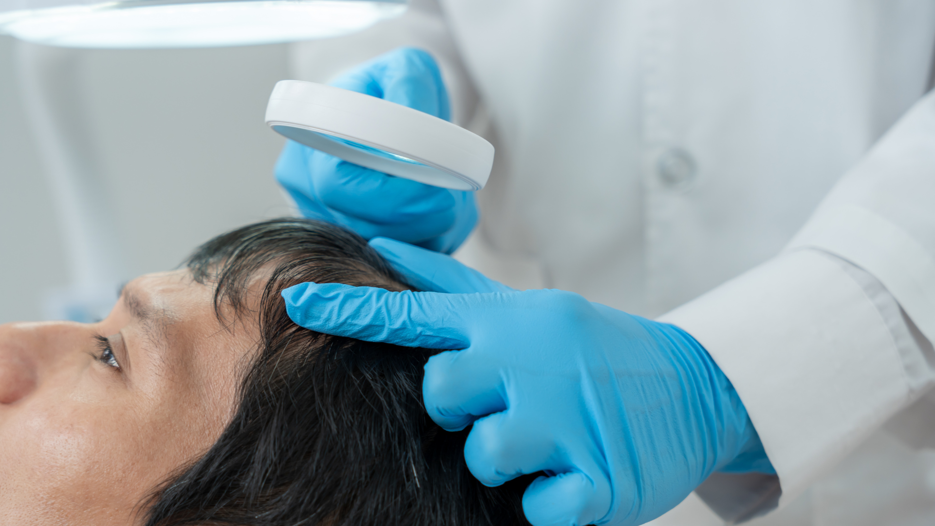 Best Hair Thinning Treatment