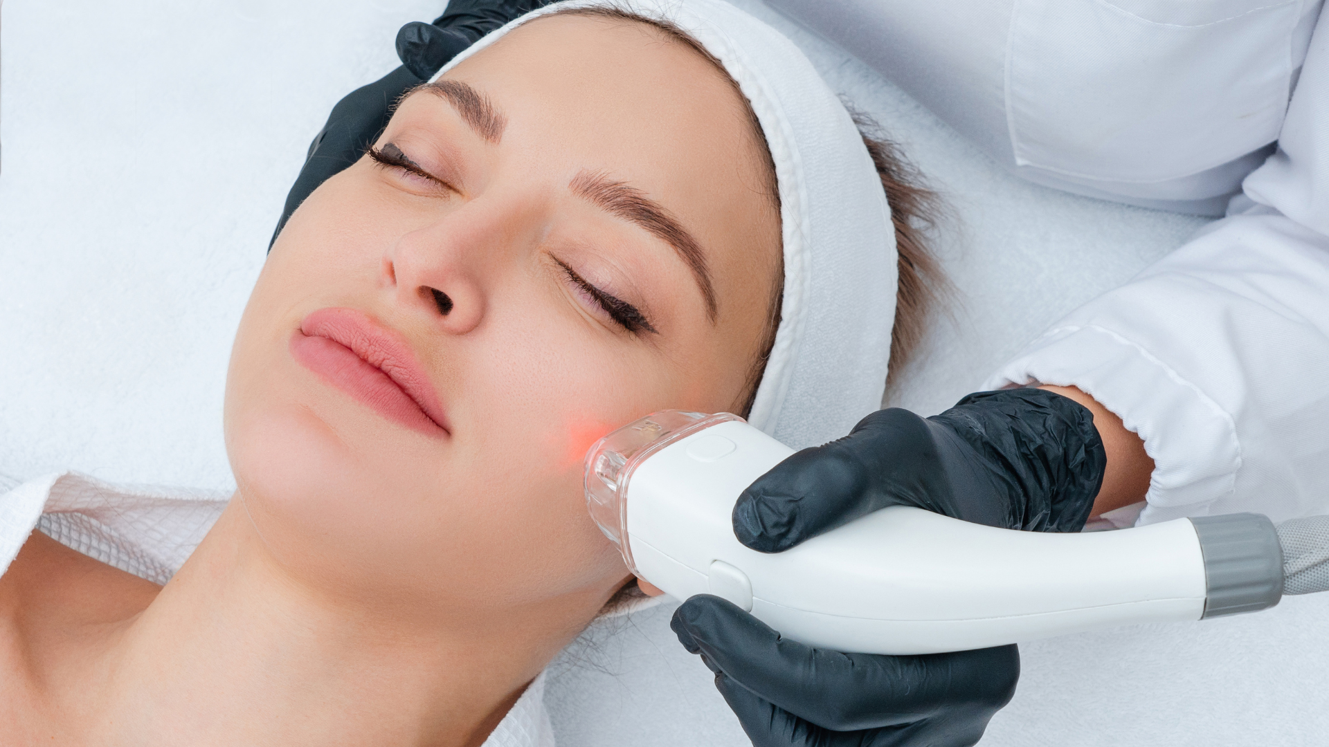 Carbon Laser Facial Treatment in Coimbatore