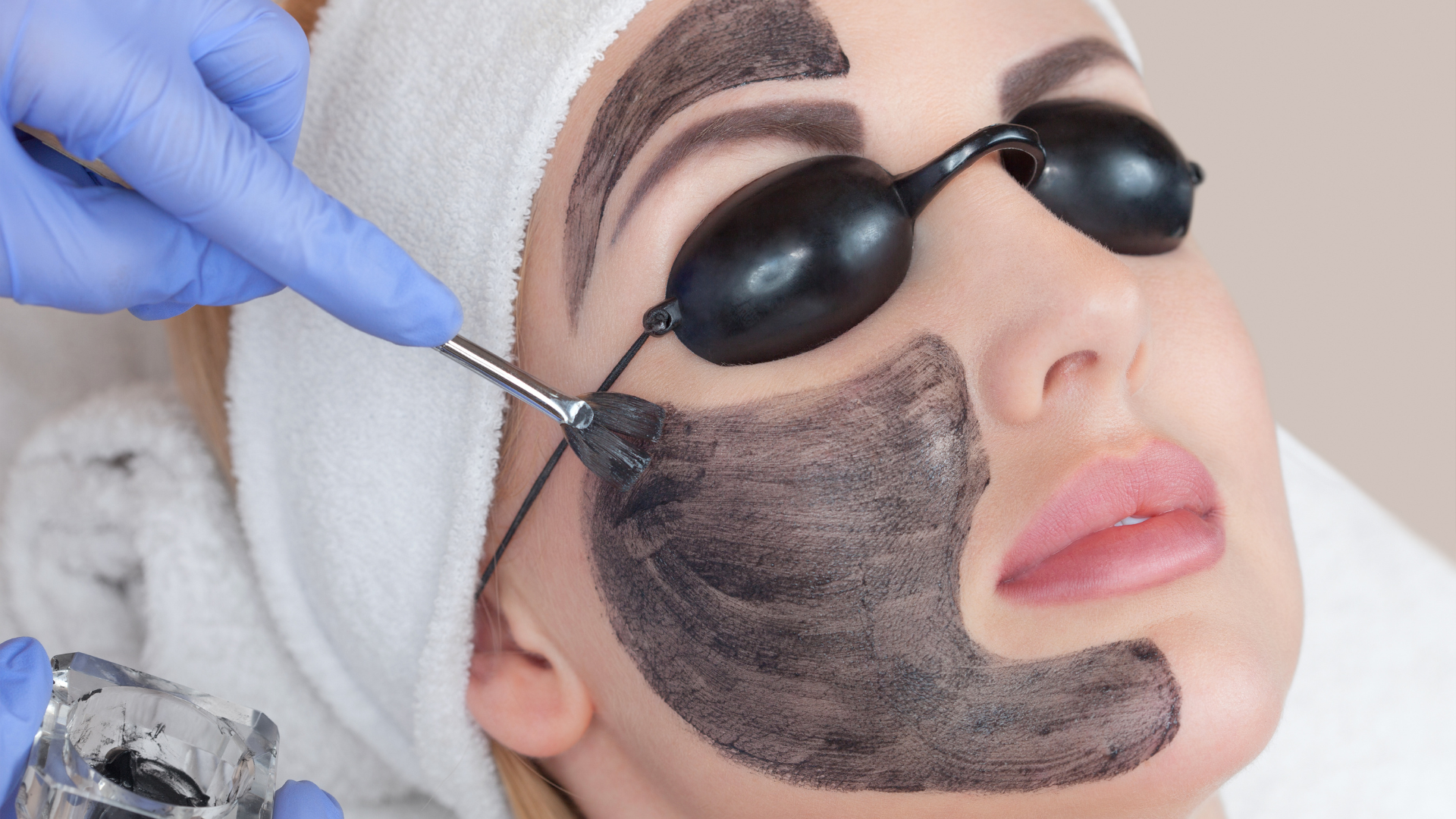 Carbon Laser Facial Treatment in Coimbatore