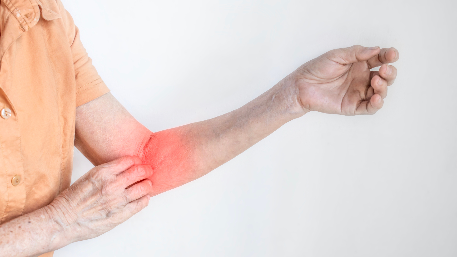 Fungal Infections Treatments 