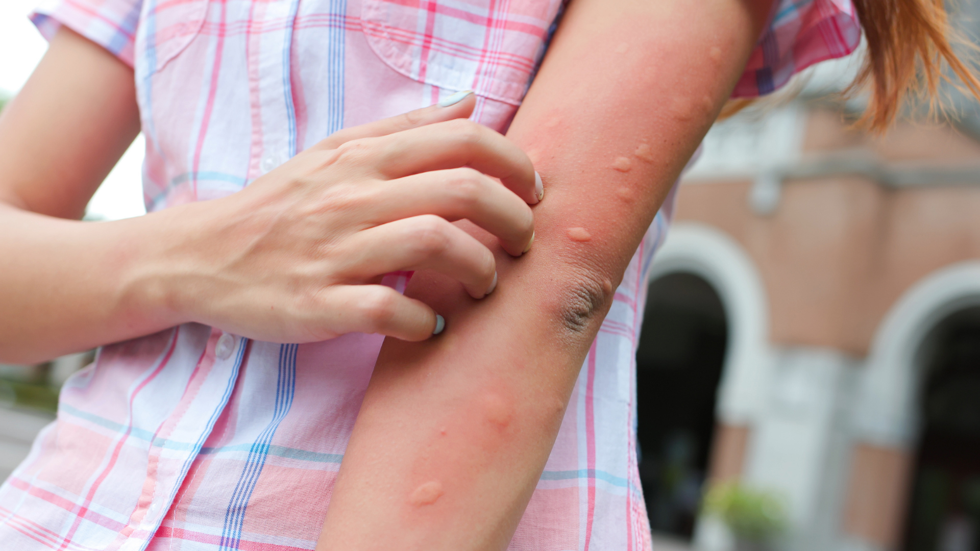 Best Fungal Infections Treatments 