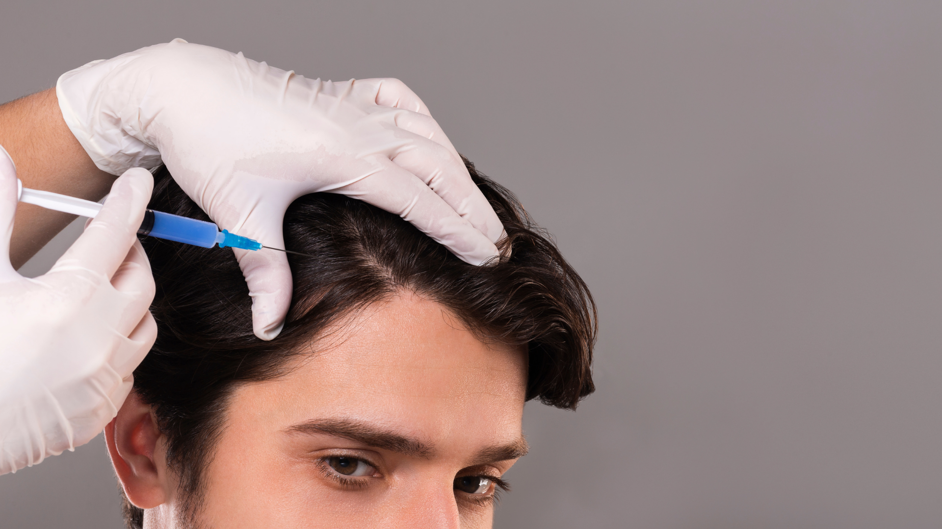 PRP Hair Treatment in Coimbatore